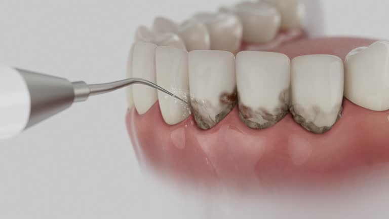 Trusted Invisalign Clear Aligners service in Farmingdale, NJ - Dentist Open Now